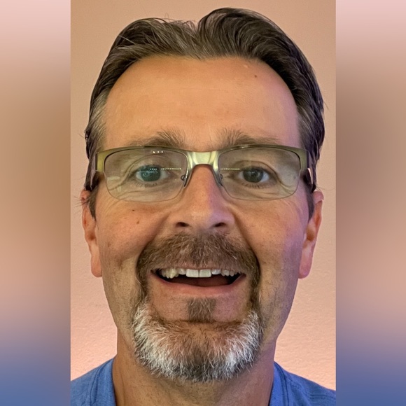 Raising money to help pay for my skin removal surgery after dropping 200 pounds! - Picture 2 of 5